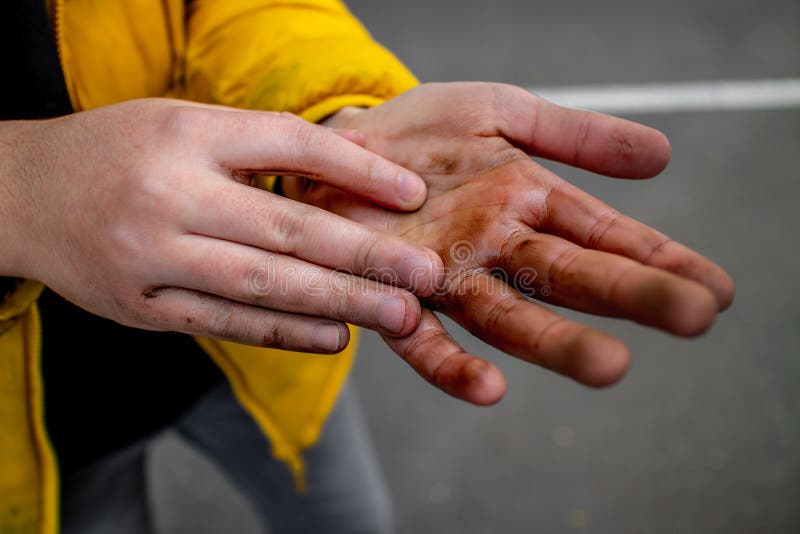 Featured image for Dirty Hotels: Addressing Hygiene Concerns and Unsanitary Conditions